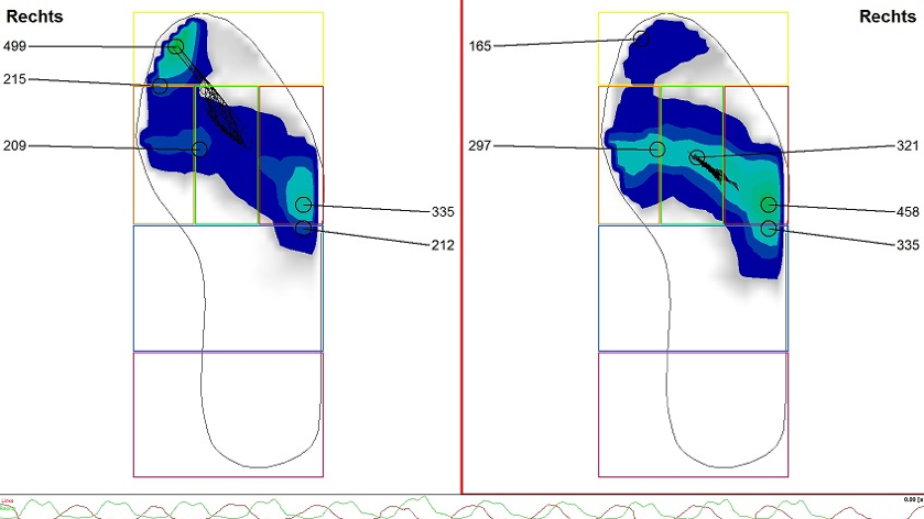 Optimale fietsafstelling met voetdrukmeting - Fit Your Bike