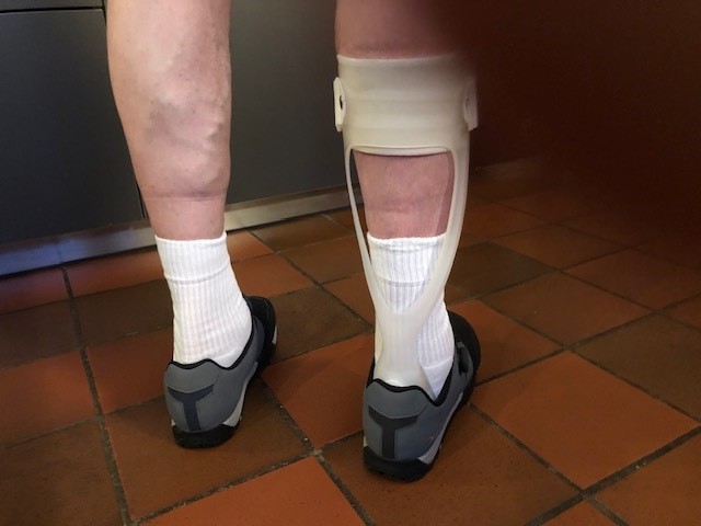 Fietsen met beperkingen: Hoe orthopedische expertise en bikefitting de vrijheid teruggeven